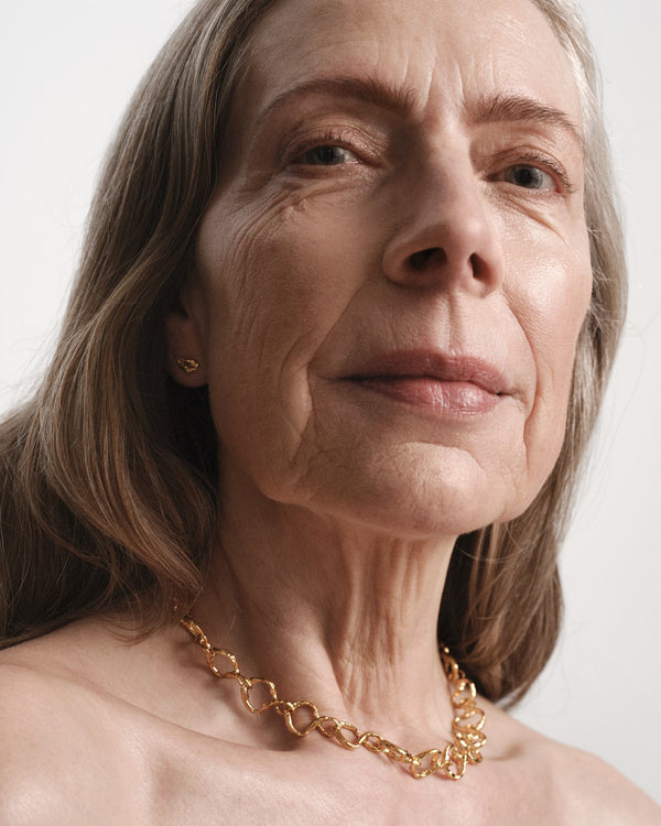 Anne